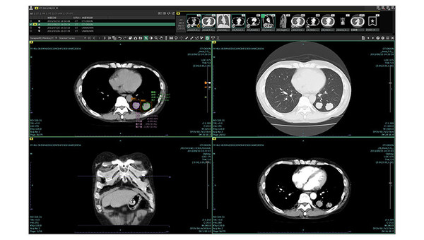 富士胶片新一代影像诊断工作站 “SYNAPSE SAI viewer V1.3”入围“GOOD DESIGN BEST 100”